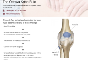 reglas de ottawa rodilla